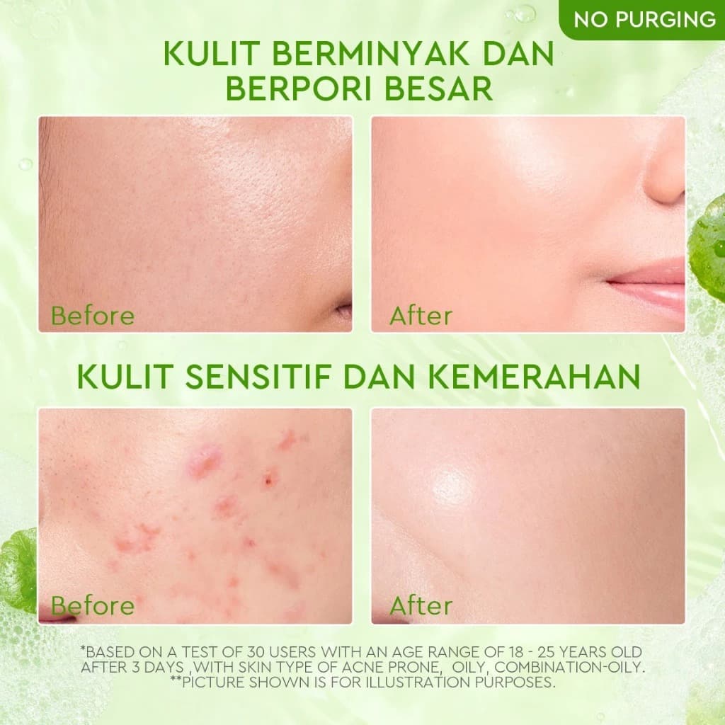 GLAD 2 GLOW CENTELLA ACNE GEL CLEANSER FACIAL WASH 70ML 4
