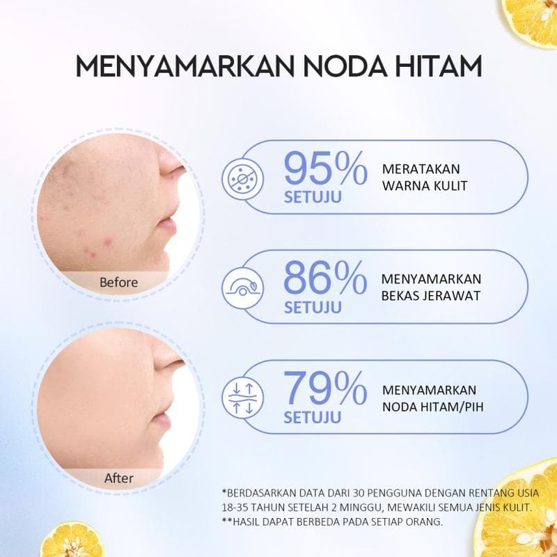 GLAD 2 GLOW YUJA 377 DARK SPOT SERUM 17ML 5