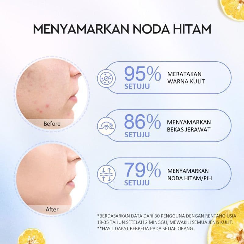 GLAD 2 GLOW YUJA 377 DARK SPOT MOISTURIZER 30GR 6