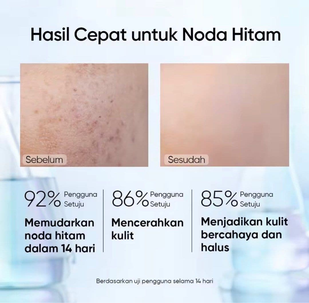 SKINTIFIC SYMWHITE 377 DARK SPOT SERUM 20ML
